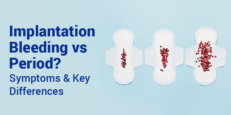 Implantation Bleeding vs. Period? Symptoms & Key Differences